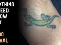 Everything You Need to Know About Tattoo Removal