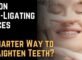 Damon Self-Ligating Braces A Smarter Way to Straighten Teeth 