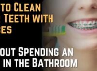 How to Clean Your Teeth with Braces Without Spending an Hour in the Bathroom